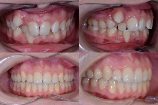 Vsledky lby - pacient 2