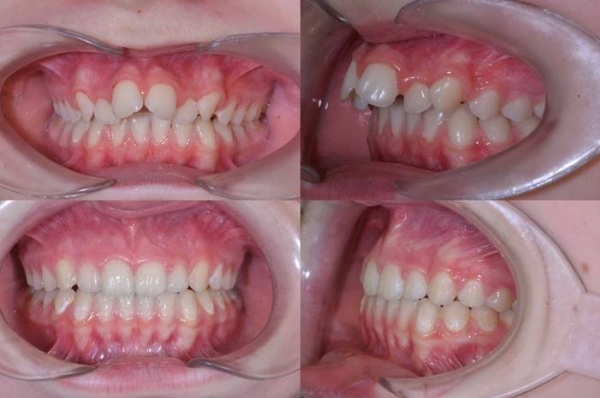 Vsledky lby - pacient 4