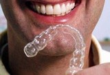 Invisalign