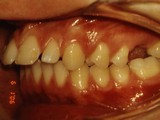 levo pac5